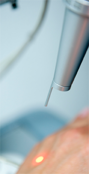 Haarentfernung-frage-antworten